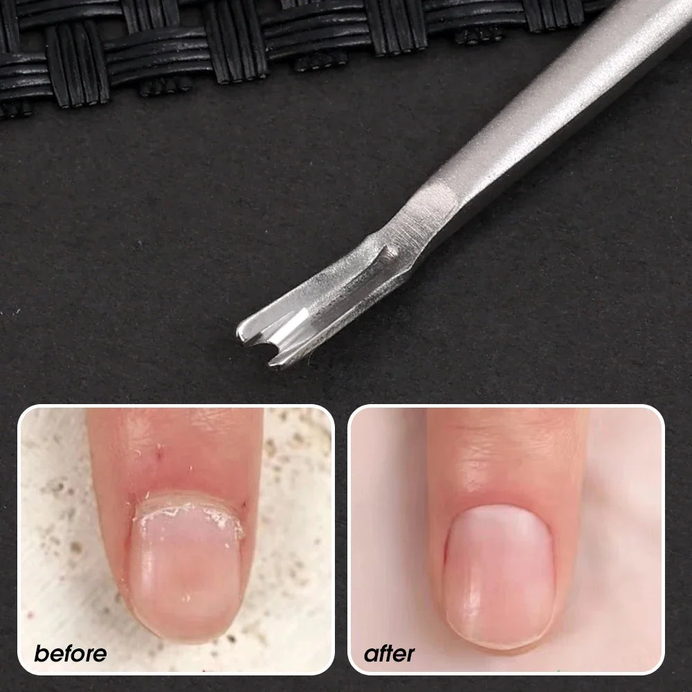 5PCS Cuticle Pusher Professional Stainless Steel Nail Cuticle Trimmer Remover Callus Dead Skin Fork Nail Manicure Pedicure Tool